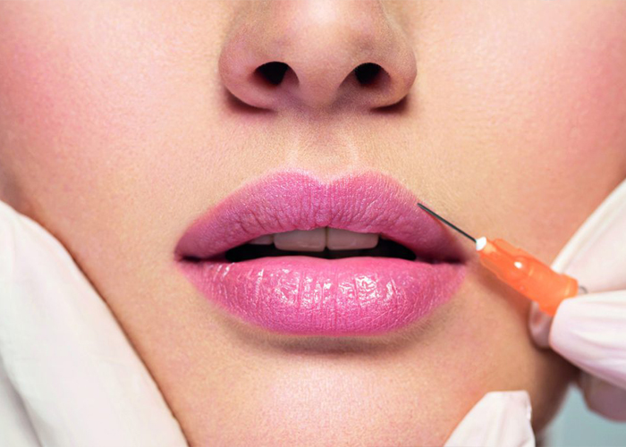 Lip Fillers Treatment